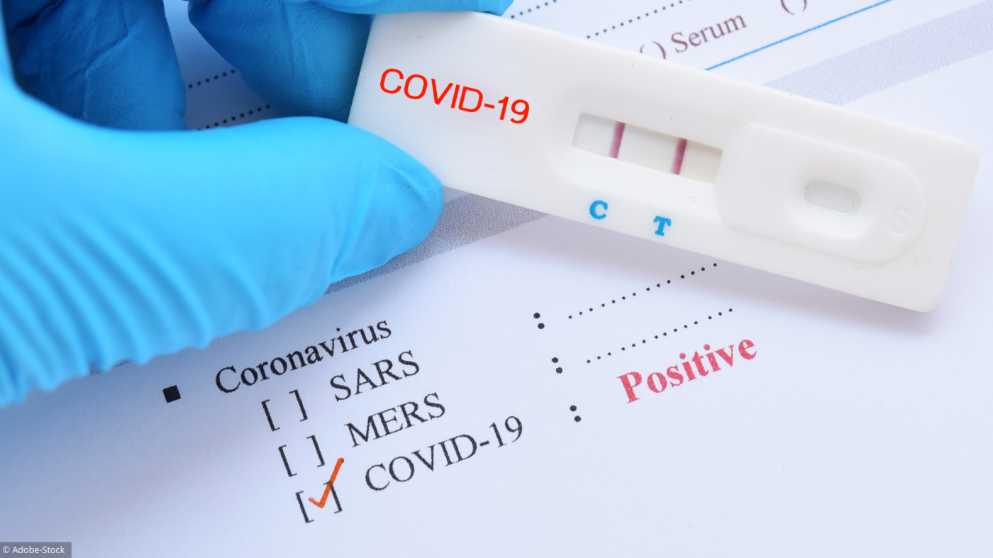 Covid-19 : Des employés de l’Asecna testés positifs dont un décès