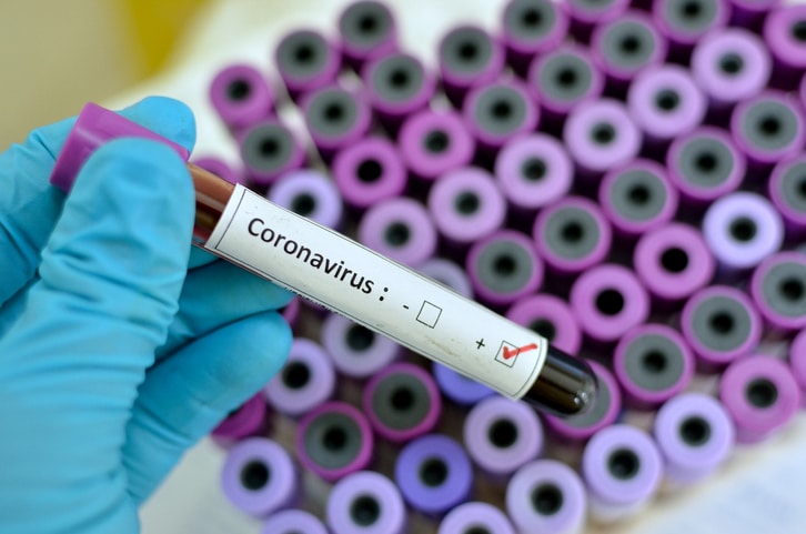 Covid-19 : 52 nouveaux cas positifs, 39 patients en réa et 16 guérisons