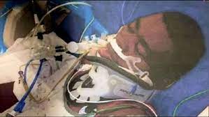 Joueur né à Dakar : Plongé dans le coma depuis 36 ans, la femme de Jean Pierre