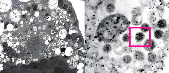 Omicron semble se diffuser plus rapidement