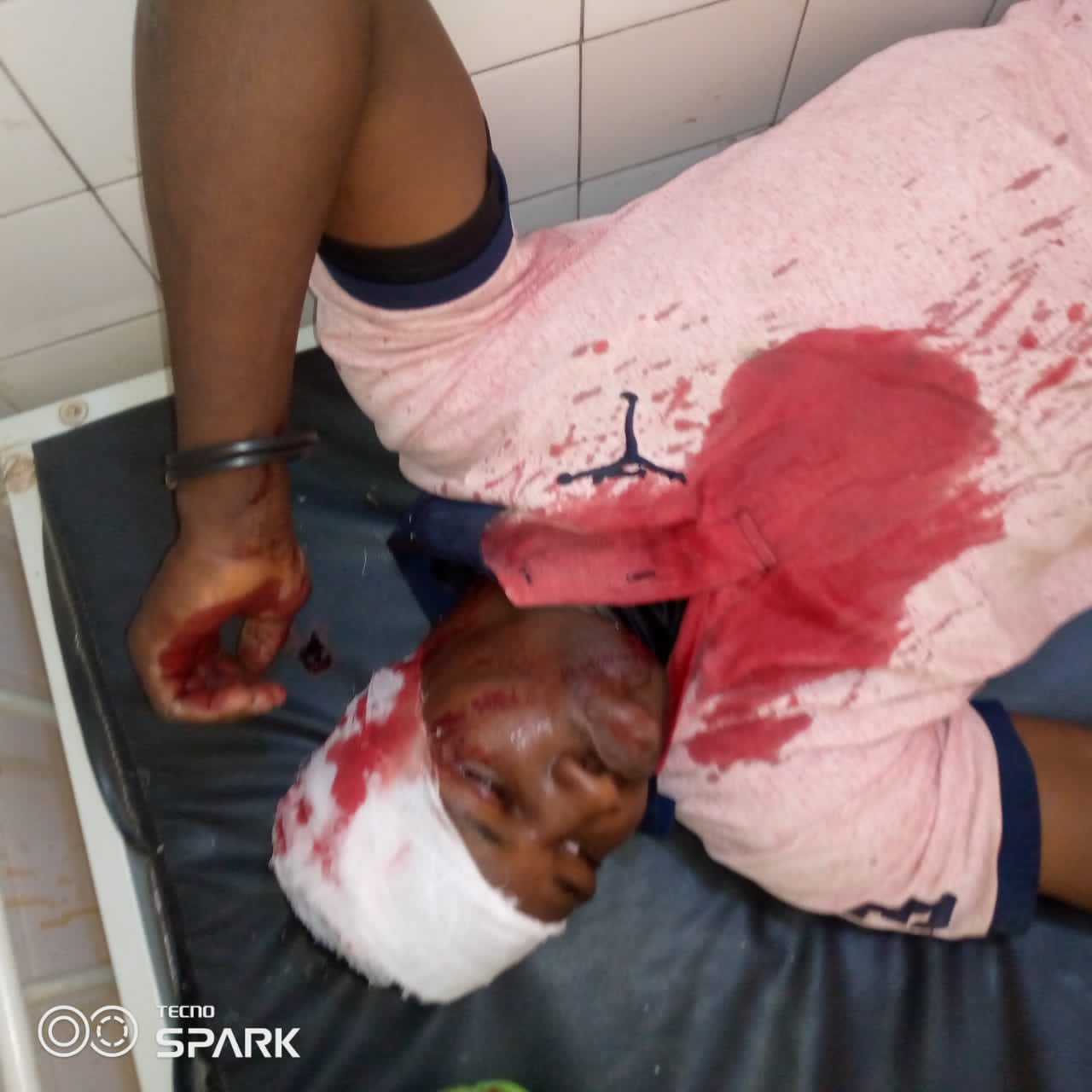 Élections locales 2022 : Les affrontements font beaucoup de dégâts